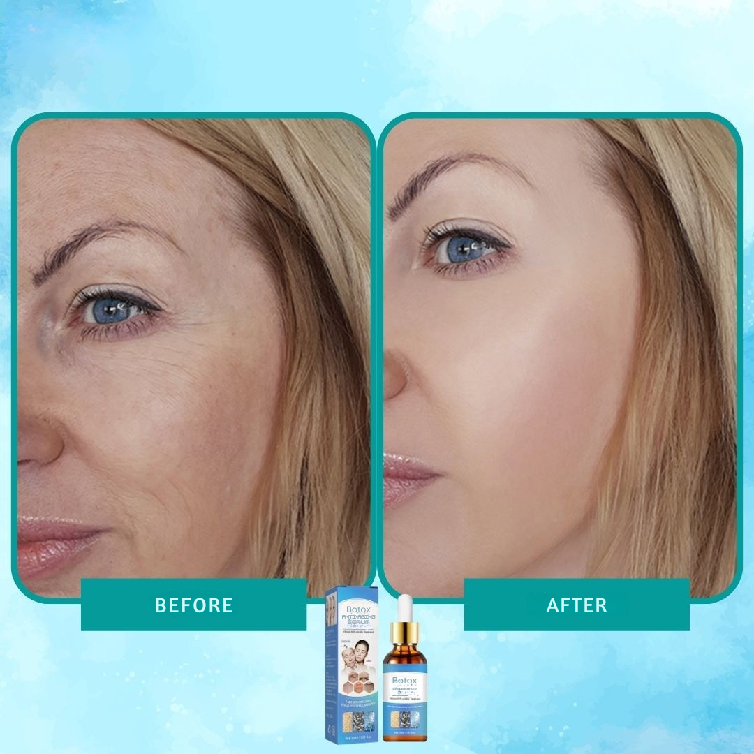 Serum botox elixir anti-aging intensiv 