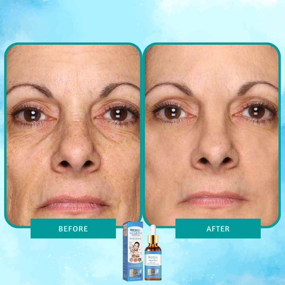 Intensi ryppyjä vastaan botox-seerumi 