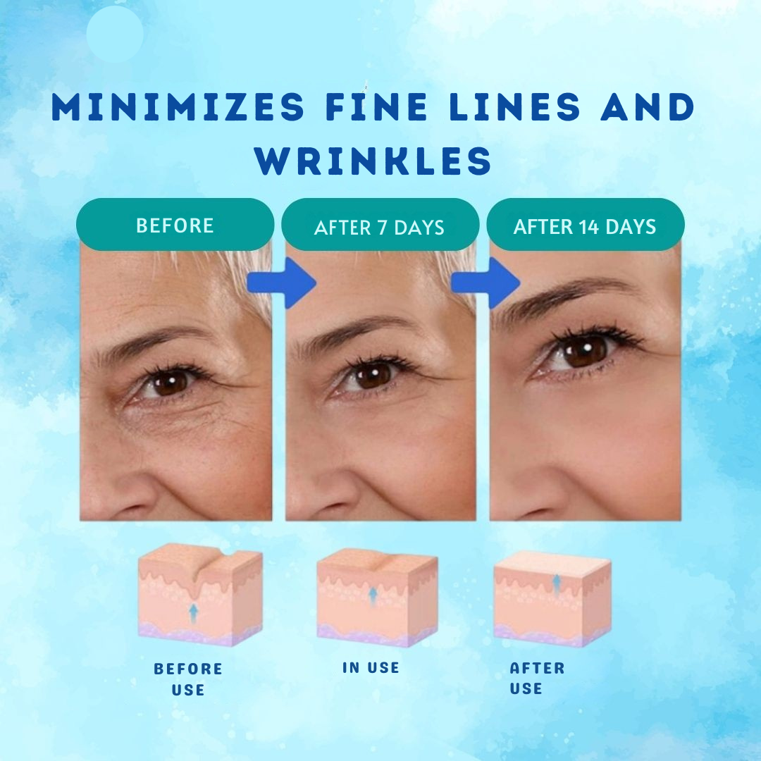 Intensi ryppyjä vastaan botox-seerumi 