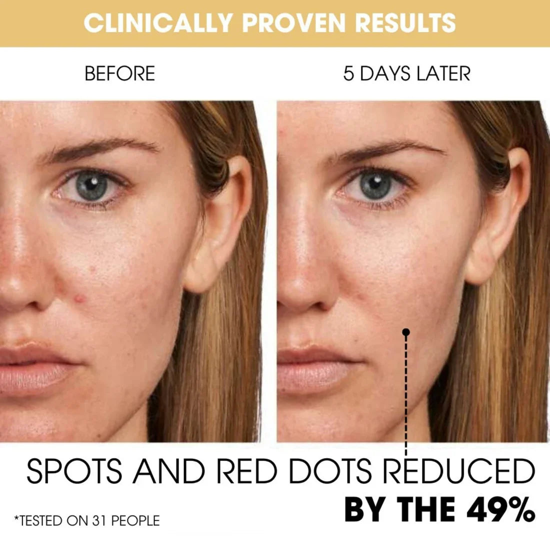 זוהר נראה ועור לח thanks לקפסולות C 